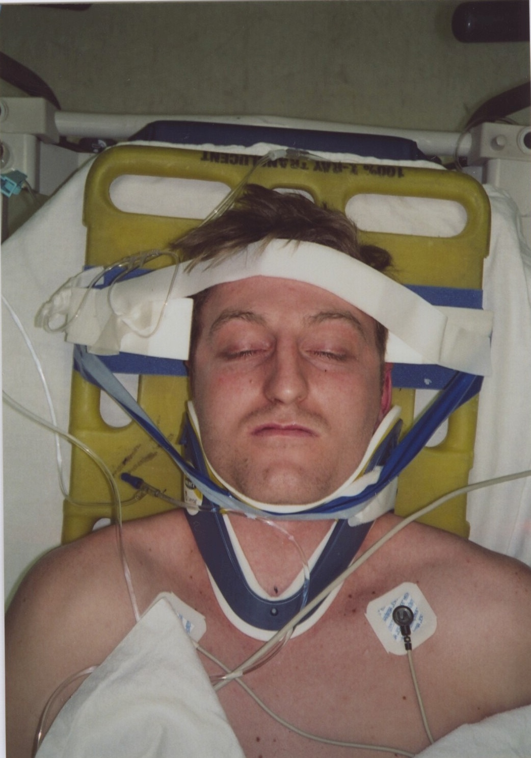 Part 2: The Accident